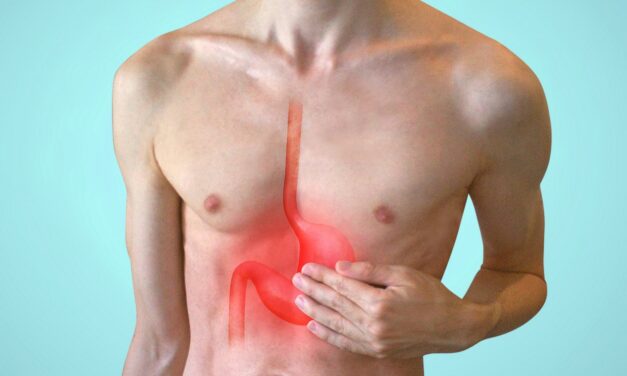 In a few sentences, about reflux disease, its treatment, and dispelling a misconception