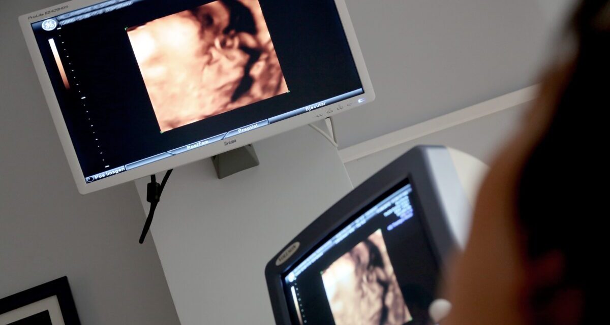 The number of abortions in Western Europe has risen dramatically