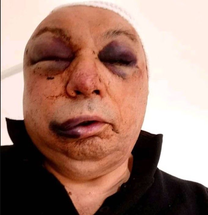 dudog lászlo antifa támadás